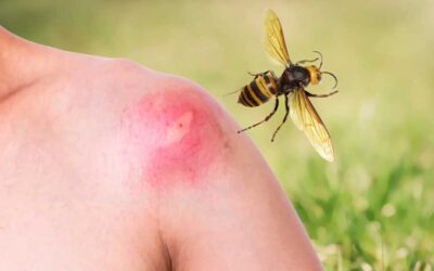 Allergici a vespe e api settanta le persone seguite